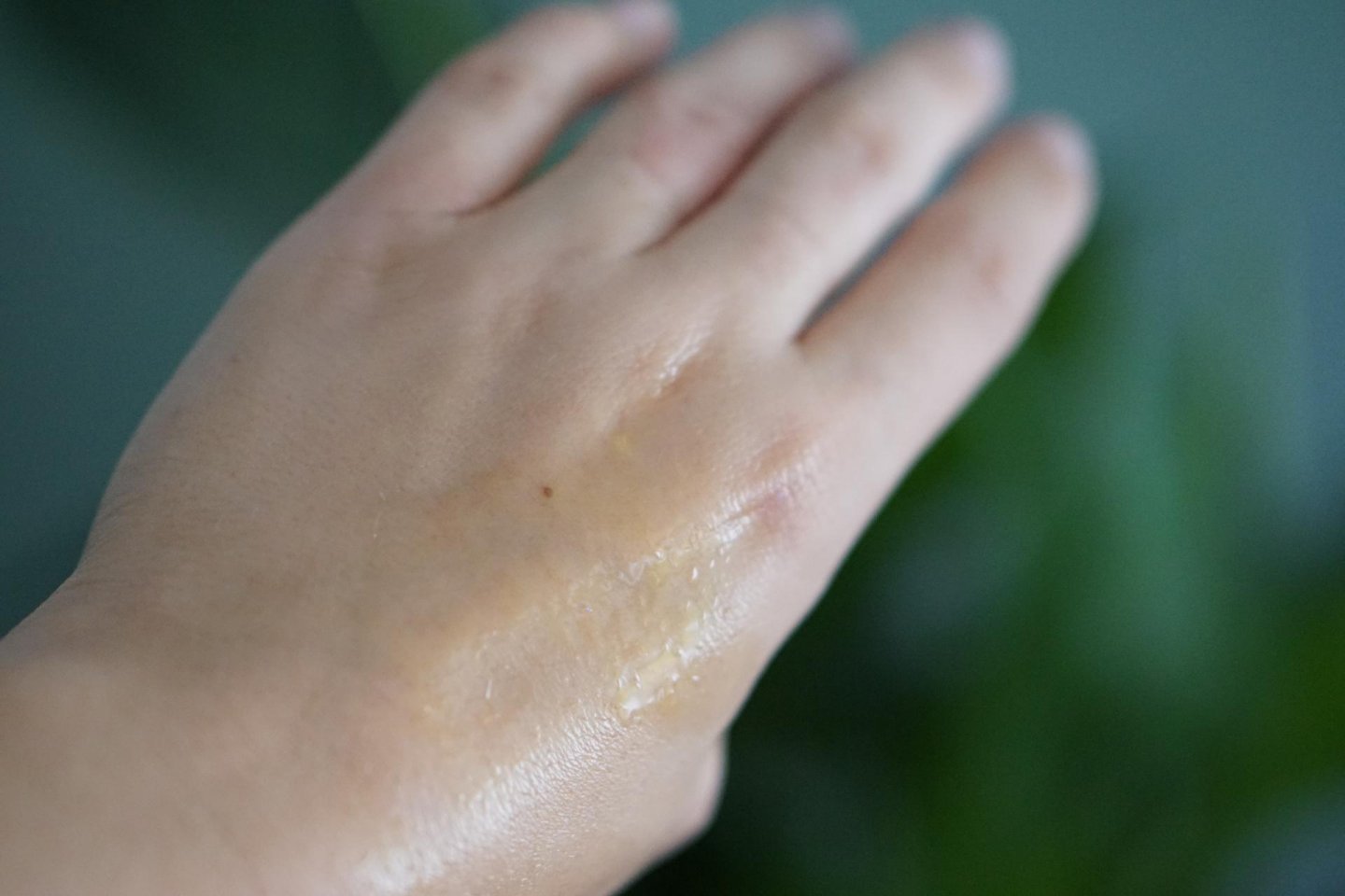 welke olie is goed voor je huid
